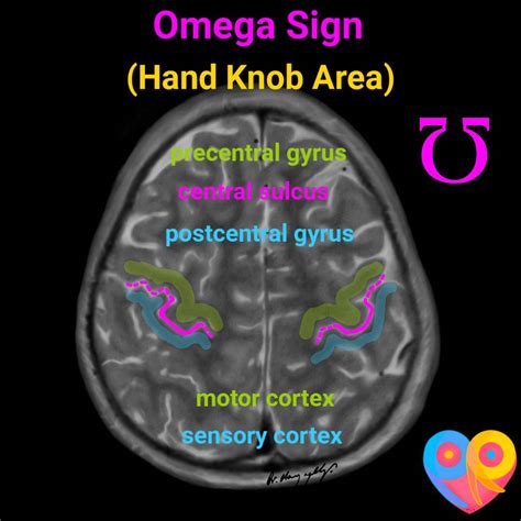 omega sign neuroimaging